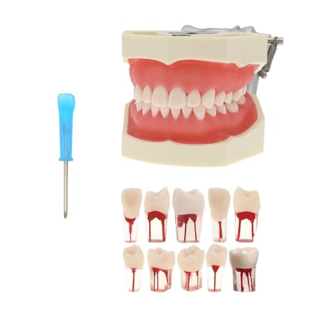 Dental Typodont Model Endodontic Root Canal Model Practice Training Pulp Cavity Study Model Teeth Model Dental Students Practice Teach M8011-Kit