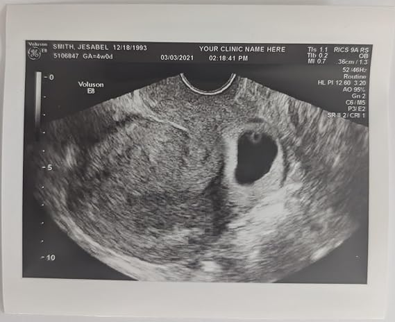 Prank 2D Customized Fake Ultrasound Single Photo ONLY NO Gender