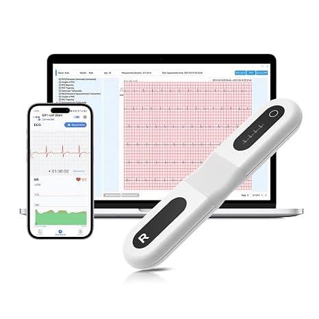 CheckMe ER1-LW 24 Hours Long-Term ECG Device for Home AI ECG Analysis ECG Monitor with OLED Screen ECG Event Marker Function Compatible with General Electrode Pads