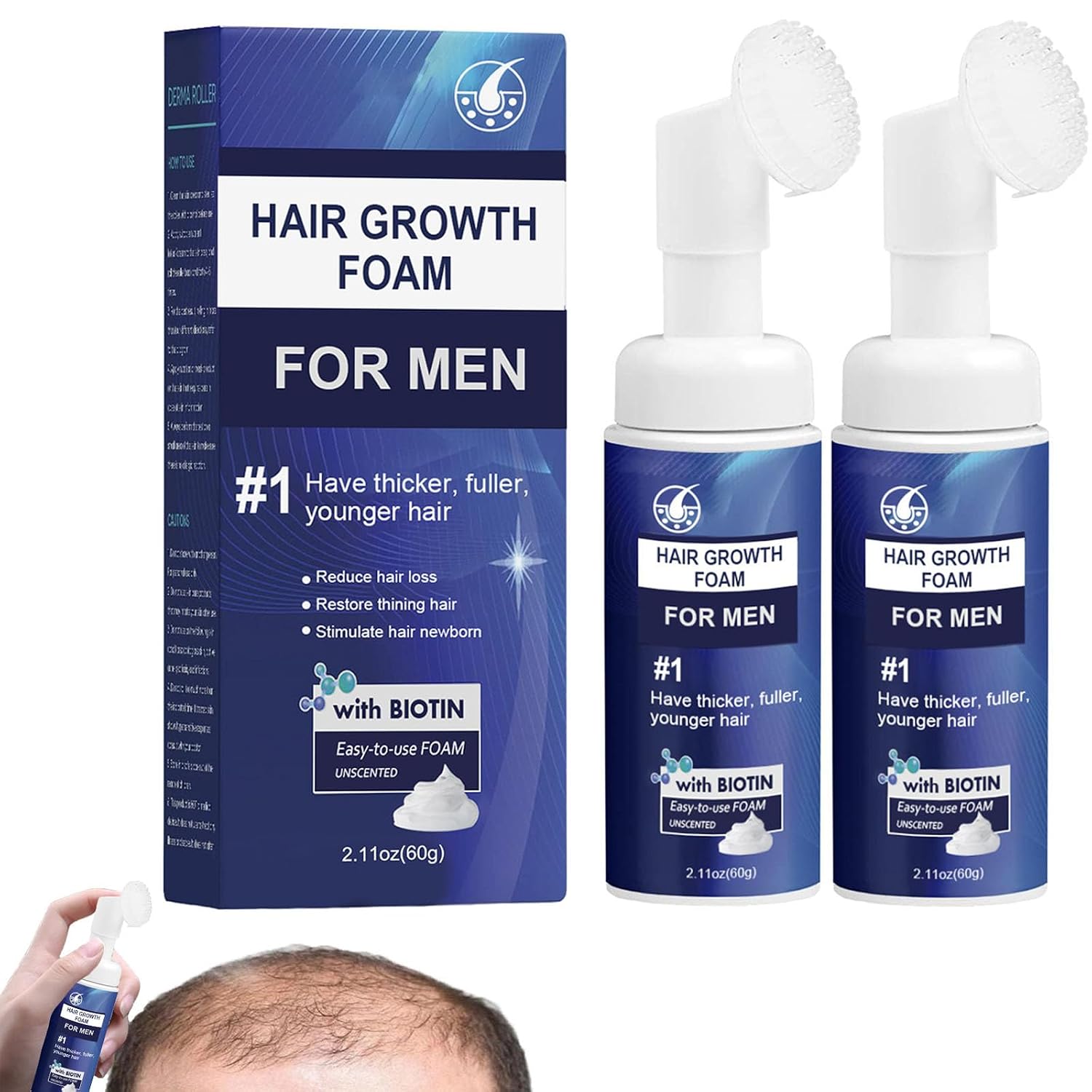 Hair Growth Foam for Men Renewhair-X Hair Growth Serum Foam Hair Regrowth Foam Anti-Hair Loss Foam Hair Treatment For All Hair Types 2 Pieces